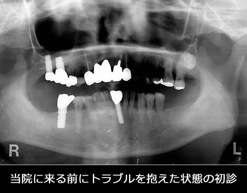 当院に来る前にトラブルを抱えた状態の初診