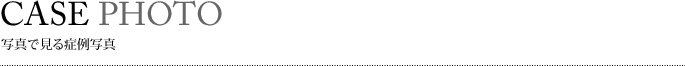 写真で見る症例写真